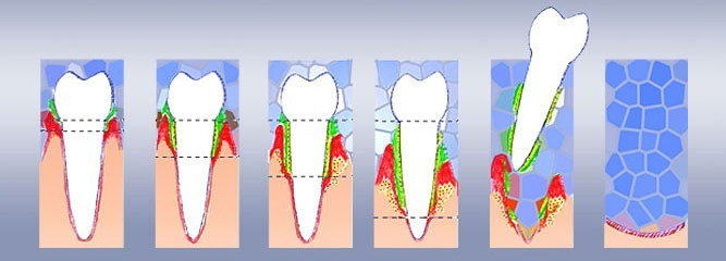 What is the periodontium and what is the role of the periodontal tissue?