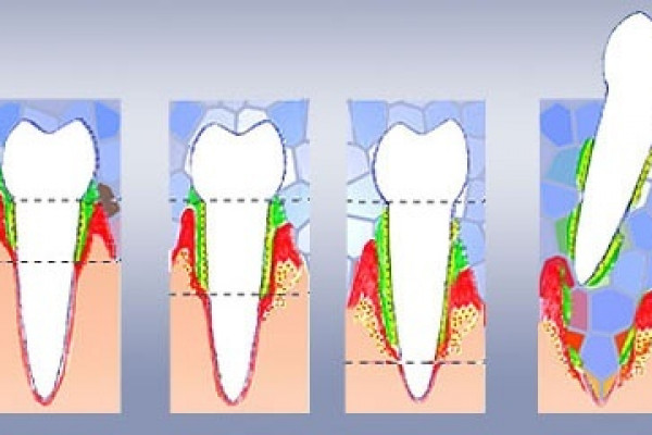 What is the periodontium and what is the role of the periodontal tissue?